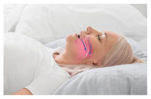 Jaw Surgery for Sleep Apnea in Buffalo, NY | Book a Consultation